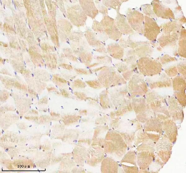  IHC analysis of PHPT1 using anti-PHPT1 antibody (A06841)