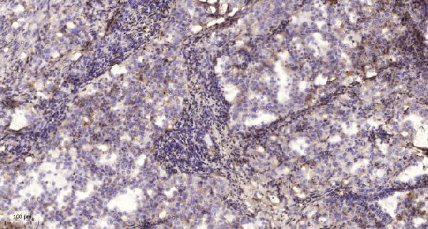 a06842 1 scn2b primary antibodies ihc testing 1