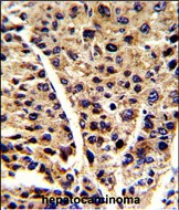 a06845 2 anti enob antibody center ihc p testing 2