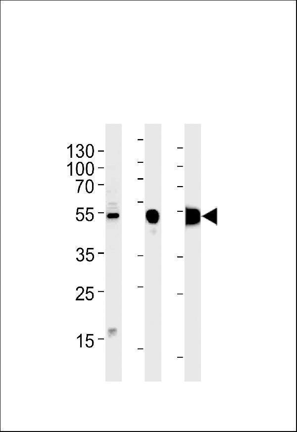 a06845 2 anti enob antibody center wb testing 1