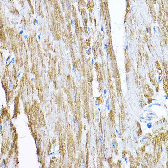 Immunohistochemistry of paraffin-embedded rat heart using SAMM50 Rabbit pAb  at dilution of 1:200 