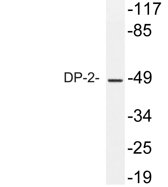 a06850 tfdp2 primary antibodies wb testing 1