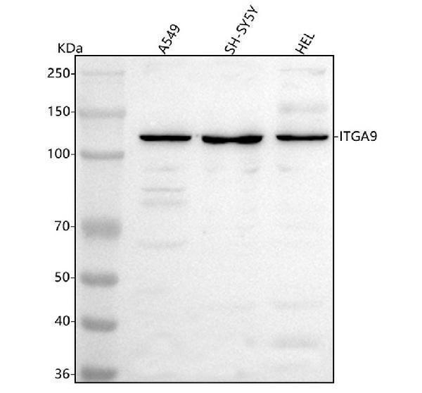  Western blot analysis of Integrin Alpha-9/ITGA9 using anti-Integrin Alpha-9/ITGA9 antibody (A06851-1)
