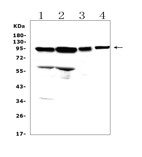 Western blot analysis of AMOTL2 using anti-AMOTL2 antibody (A06852). Electrophoresis was performed on a 5-20% SDS-PAGE gel at 70V (Stacking gel) / 90V (Resolving gel) for 2-3 hours. The sample well of each lane was loaded with 50ug of sample under reducing conditions. Lane 1: rat brain tissue lysates, Lane 2: rat lung tissue lysates, Lane 3: mouse lung tissue lysates, Lane 4: mouse liver tissue lysates. After Electrophoresis, proteins were transferred to a Nitrocellulose membrane at 150mA for 50-90 minutes. Blocked the membrane with 5% Non-fat Milk/ TBS for 1.5 hour at RT. The membrane was incubated with rabbit anti-AMOTL2 antigen affinity purified polyclonal antibody (Catalog # A06852) at 0.5 μg/mL overnight at 4°C, then washed with TBS-0.1%Tween 3 times with 5 minutes each and probed with a goat anti-rabbit IgG-HRP secondary antibody at a dilution of 1:10000 for 1.5 hour at RT. The signal is developed using an Enhanced Chemiluminescent detection (ECL) kit (Catalog # EK1002) with Tanon 5200 system. A specific band was detected for AMOTL2 at approximately 95KD. The expected band size for AMOTL2 is at 86KD.