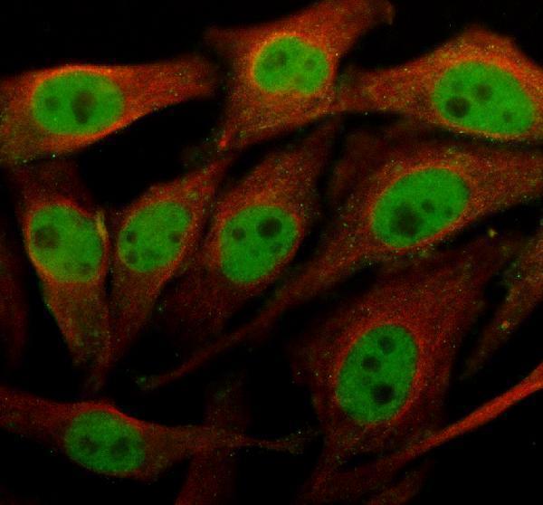 IF analysis of POM121 using anti-POM121 antibody (A06856-2) and anti-Alpha Tubulin antibody (M03989-3)