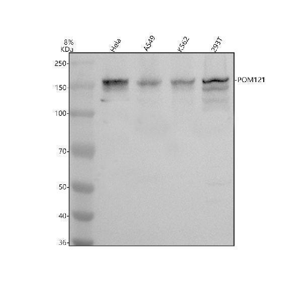 Western blot analysis of POM121 using anti-POM121 antibody (A06856-2)