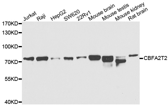 Western blot analysis of extracts of various cell lines, using CBFA2T2 antibody