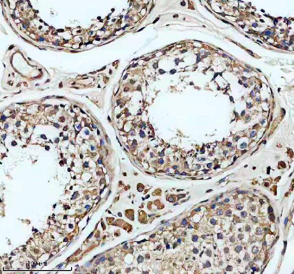 IHC analysis of SLC22A16 using anti-SLC22A16 antibody (A06860-1)
