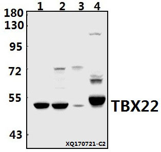 a06861 1 tbx22 primary antiboties wb testing 1