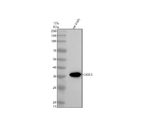 Western blot analysis of CXXC5 using anti-CXXC5 antibody (A06865-1)