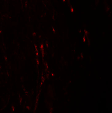 a06865 cxxc5 primary antibodies if testing 3