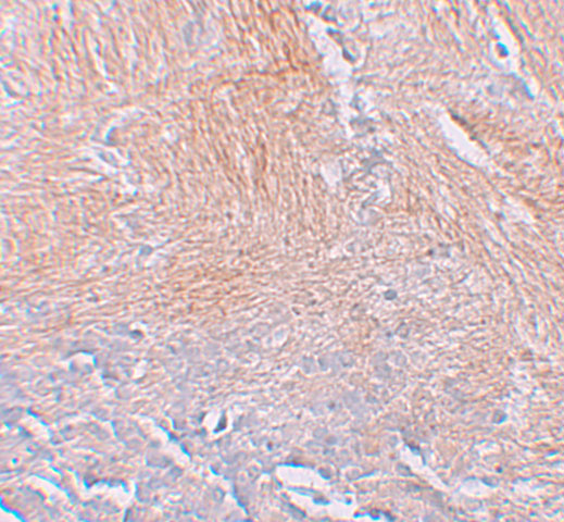 a06865 cxxc5 primary antibodies ihc testing 2