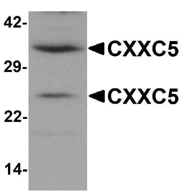 a06865 cxxc5 primary antibodies wb testing 1