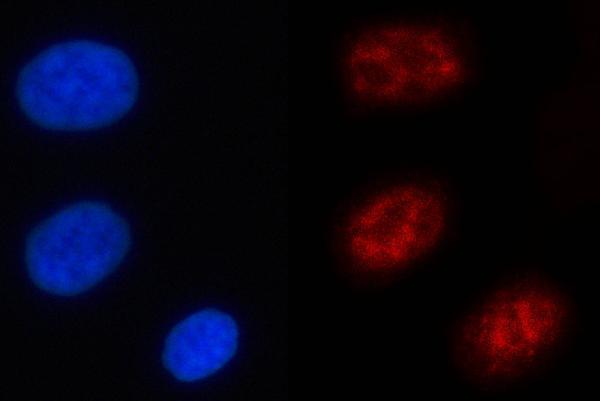 IF analysis of NFRKB using anti-NFRKB antibody (A06867-2)