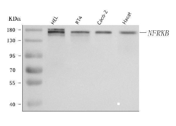 Western blot analysis of NFRKB using anti-NFRKB antibody (A06867-2)