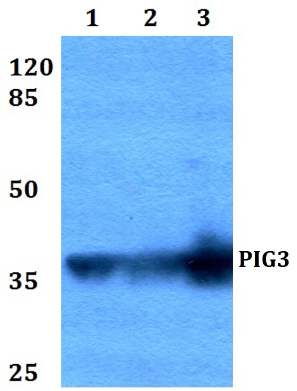 Western blot (WB) analysis of PIG3 (L265) polyclonal antibody at 1:500 dilution
Lane1:HEK293T whole cell lysate
Lane2:Raw264