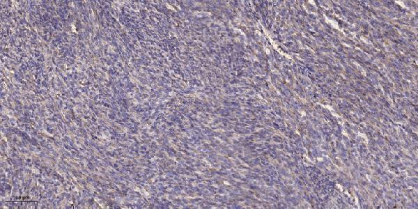 a06870 2 tp53i3 primary antibodies ihc testing 1