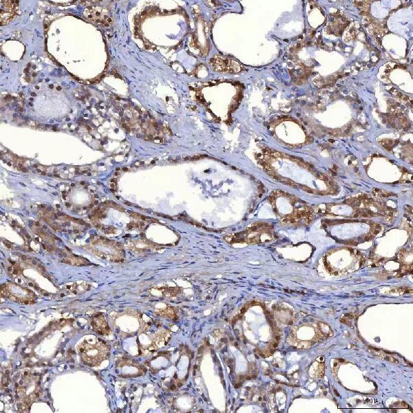  IHC analysis of PIG3/TP53I3 using anti-PIG3/TP53I3 antibody (A06870-3)