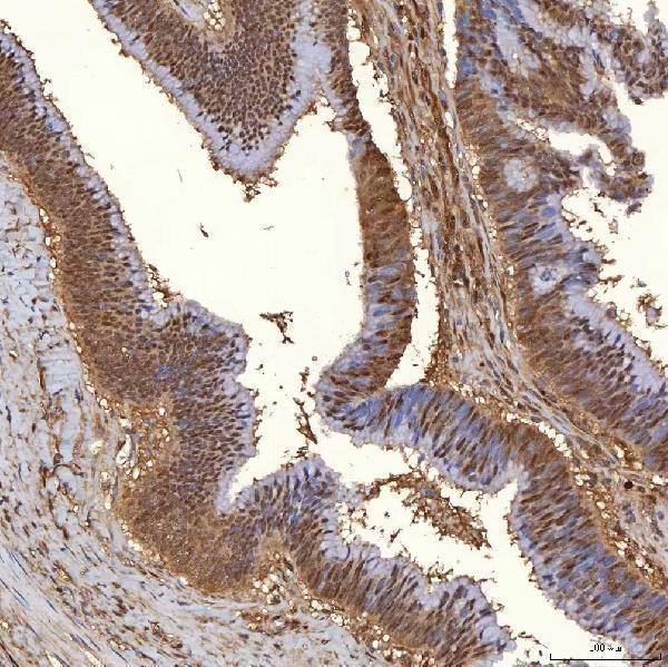 a06870 3 tp53i3 primary antibodies ihc testing 4