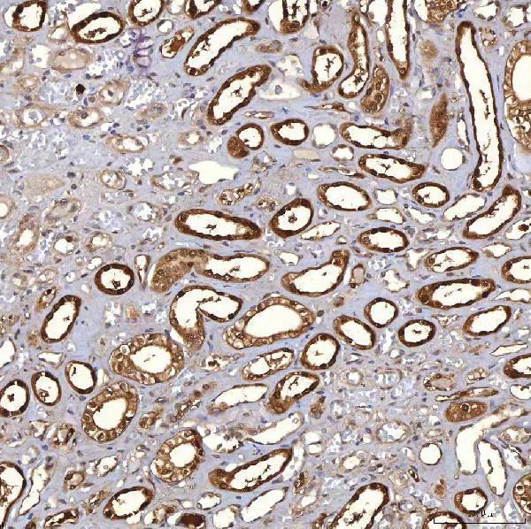 a06870 3 tp53i3 primary antibodies ihc testing 5