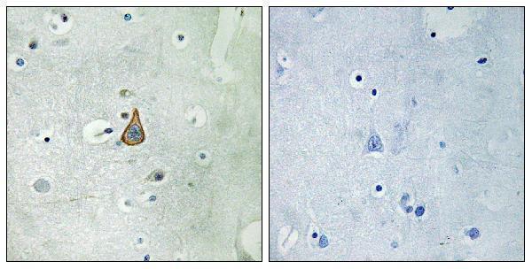 Immunohistochemistryt analysis of paraffin-embedded human brain, using KCNC1 Antibody