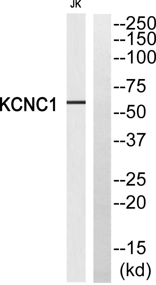Western blot analysis of KCNC1 Antibody