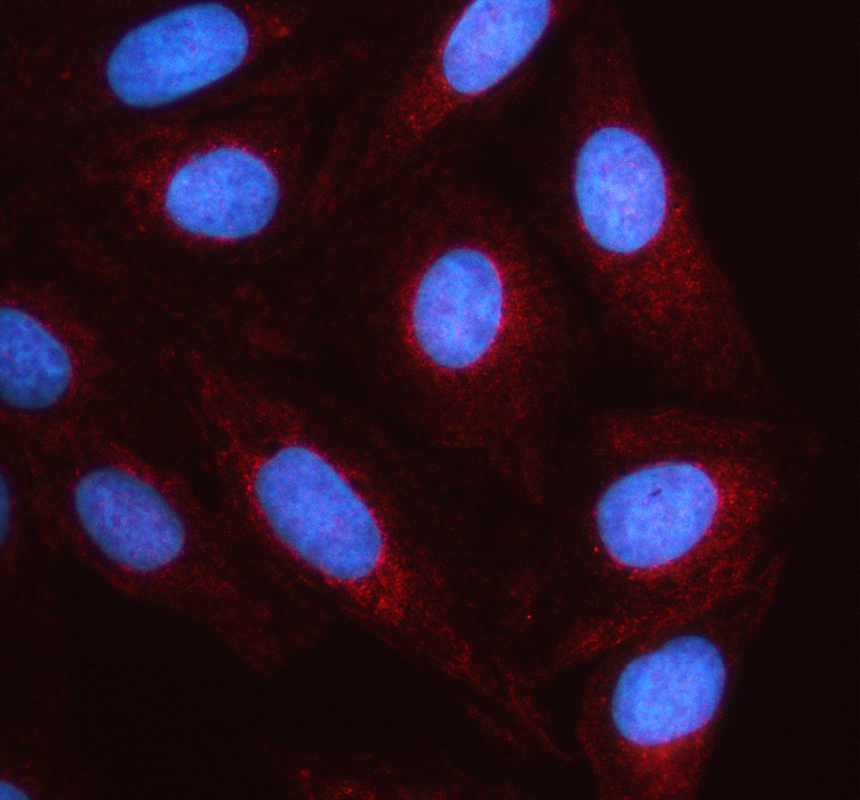 a06871 2 kcnc1 primary antibodies if testing 1