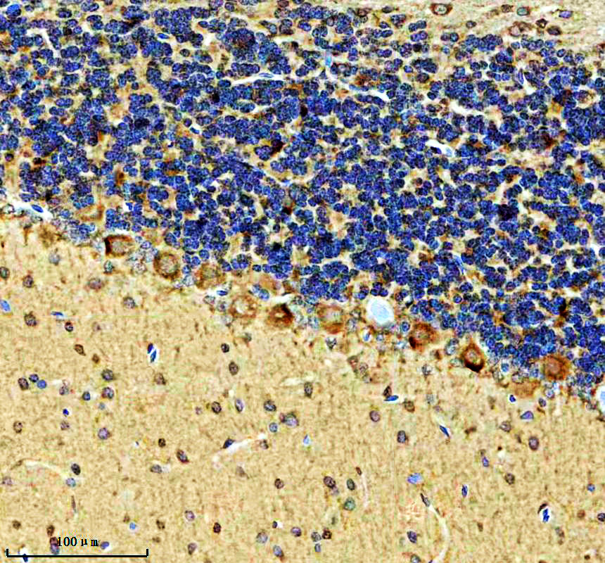 IHC analysis of KCNC1 using anti-KCNC1 antibody (A06871-2)