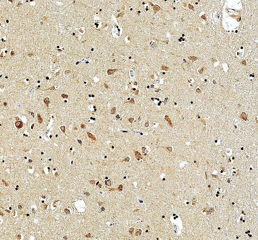 IHC analysis of KCNC1 using anti-KCNC1 antibody (A06871-2)