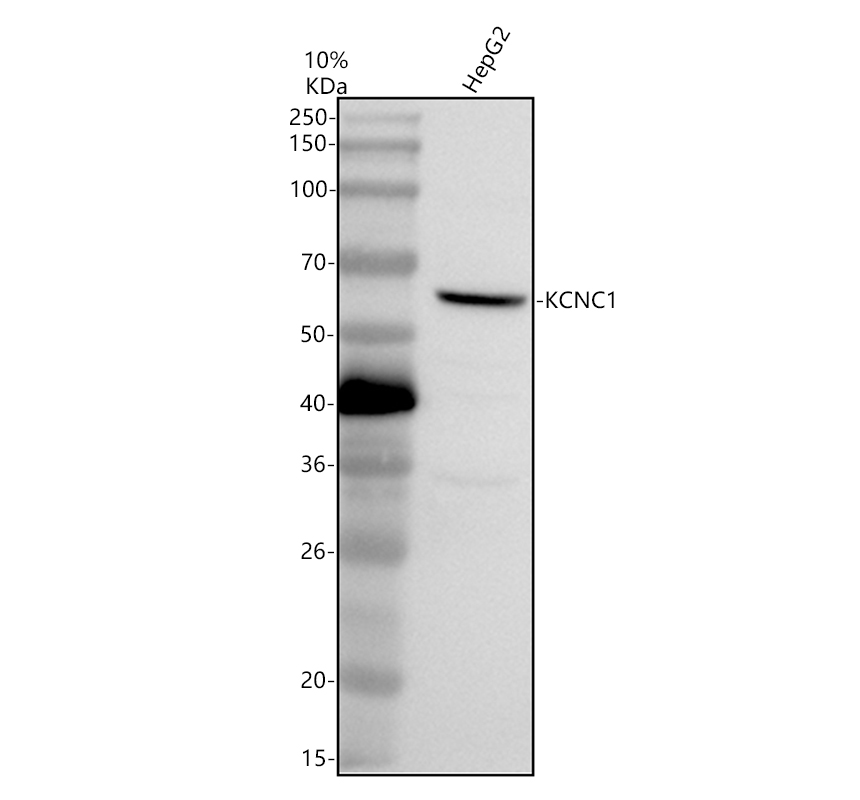 Western blot analysis of KCNC1 using anti-KCNC1 antibody (A06871-2)