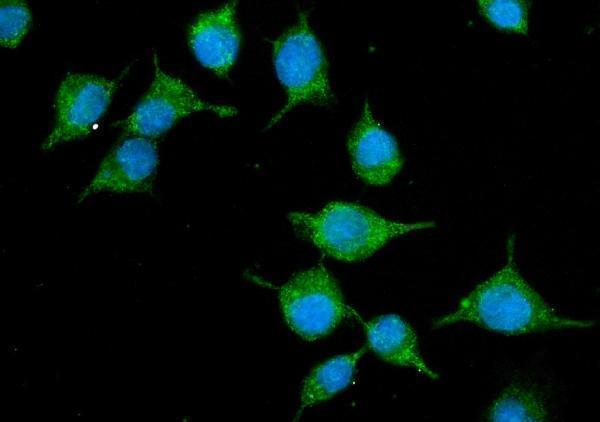 a06872 1 slc10a1 primary antibodies if testing 4