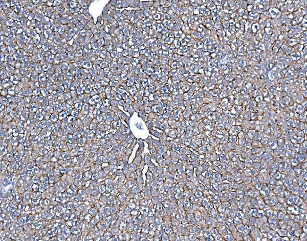 a06872 1 slc10a1 primary antibodies ihc testing 3