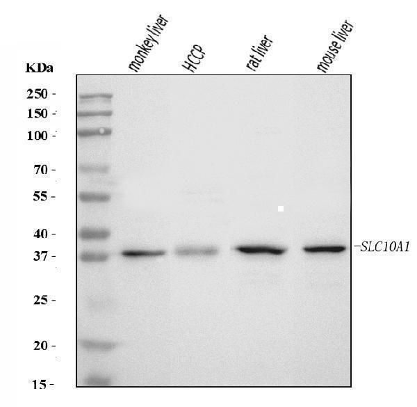  Western blot analysis of SLC10A1/NTCP1 using anti-SLC10A1/NTCP1 antibody (A06872-2)