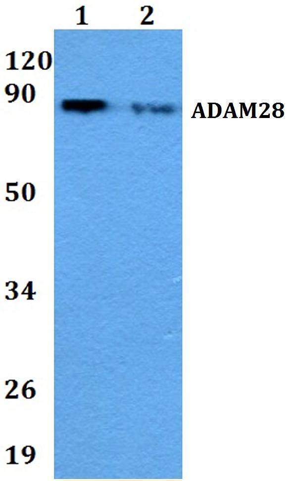 Western blot (WB) analysis of ADAM28 polyclonal antibody at 1:500 dilution
Lane1:A549 whole cell lysate
Lane2:Raw264