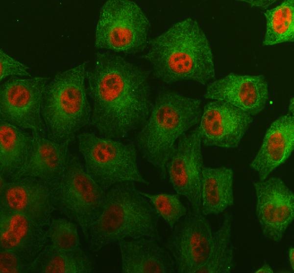 a06874 2 arpc3 primary antibodies if testing 1