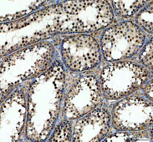 a06874 2 arpc3 primary antibodies ihc testing 1