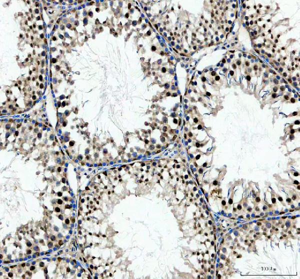 a06874 2 arpc3 primary antibodies ihc testing 2