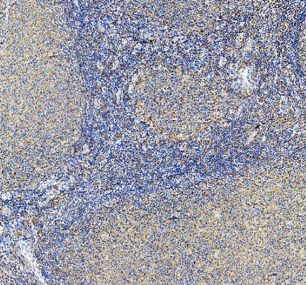 a06874 2 arpc3 primary antibodies ihc testing 3