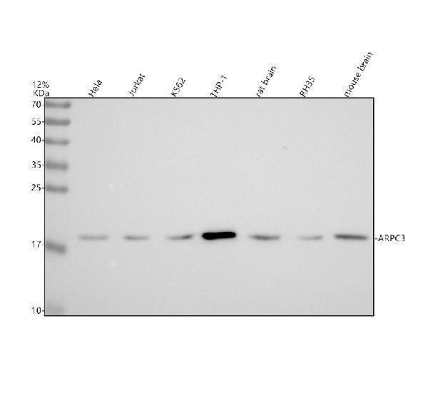 Western blot analysis of ARPC3 using anti-ARPC3 antibody (A06874-2)