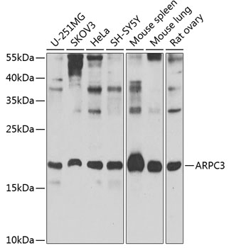 a06874 arpc3 primary antiboties wb testing 1