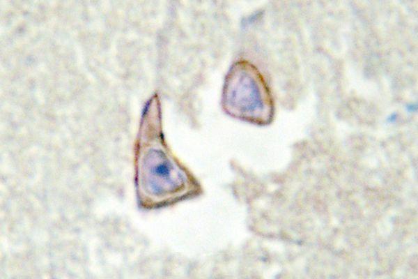 a06876 1 ksr2 primary antiboties ihc testing 2