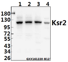 a06876 1 ksr2 primary antiboties wb testing 1