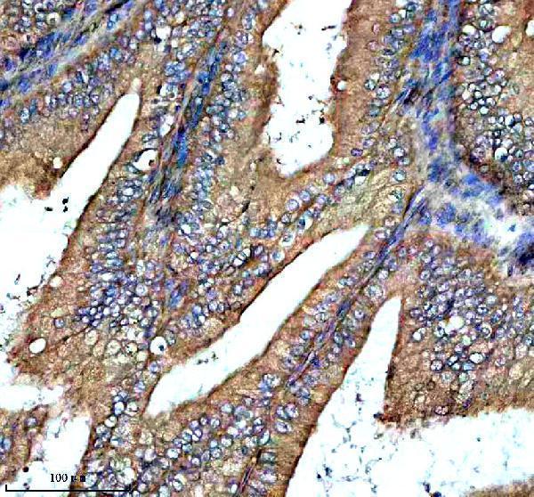 a06877 padi2 primary antibodies ihc testing 1