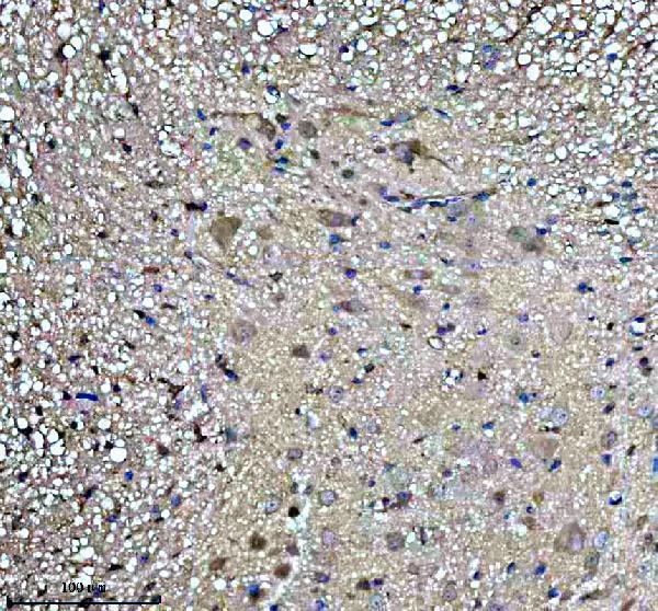 a06877 padi2 primary antibodies ihc testing 3
