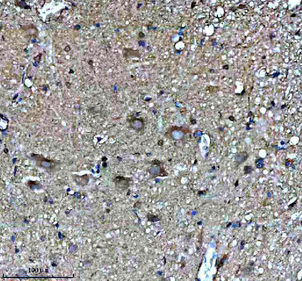 a06877 padi2 primary antibodies ihc testing 4
