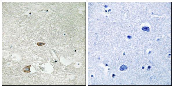 a06880 celsr2 primary antibodies ihc testing 2