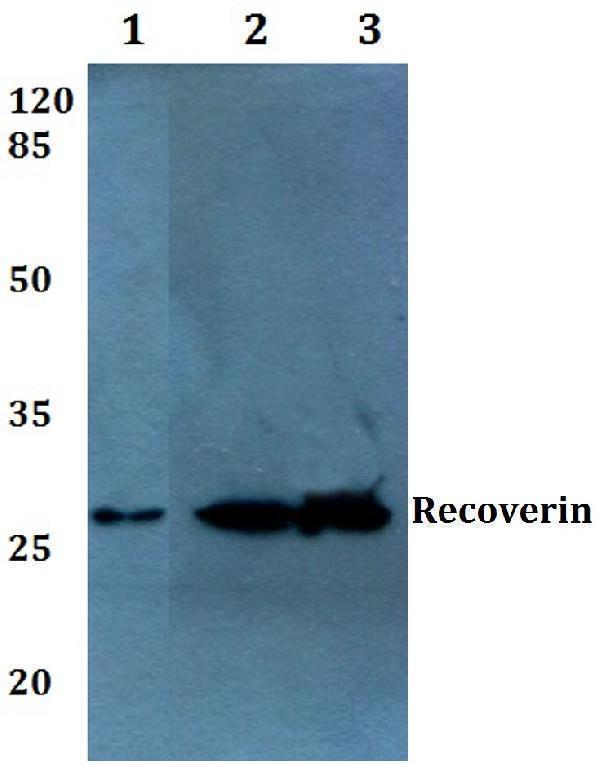 Western blot (WB) analysis of Recoverin (D143) pAb at 1:500 dilution
Lane1:The Heart tissue lysate of Mouse(40ug)
Lane2:HEK293T whole cell lysate(40ug)
Lane3:The Eye tissue lysate of Mouse(40ug)
Lane4:The Eye tissue lysate of Rat(40ug)