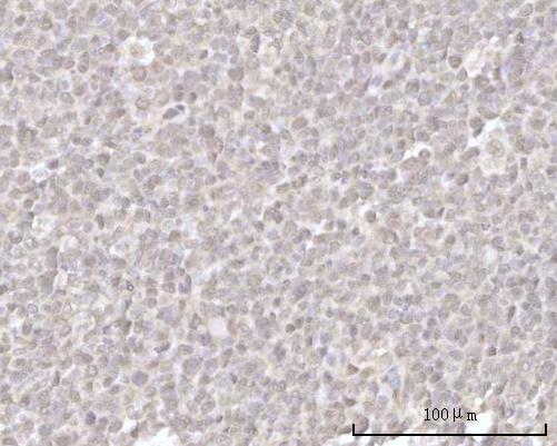  IHC analysis of Recoverin/RCVRN using anti-Recoverin/RCVRN antibody (A06882-2)