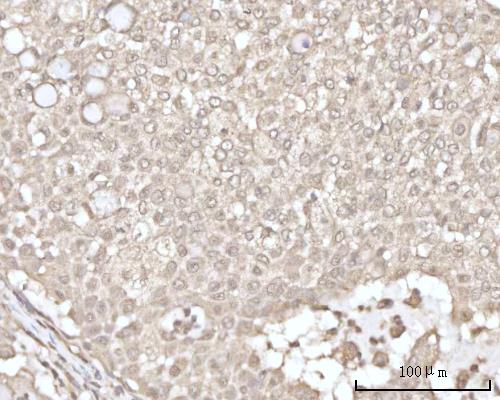  IHC analysis of Recoverin/RCVRN using anti-Recoverin/RCVRN antibody (A06882-2)