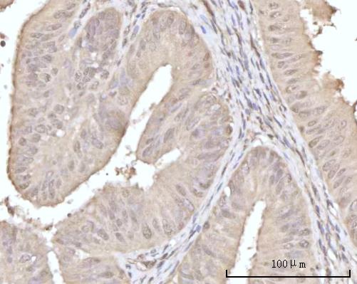 a06882 2 rcvrn primary antibodies ihc testing 6